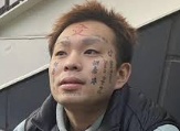 顔面ニキ